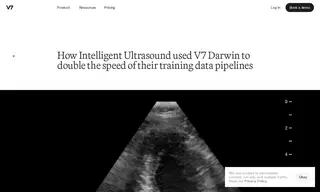 Preview of the Intelligent Ultrasound Case Study