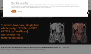 Preview of the Tübingen University Hospital Case Study