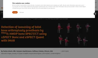 Preview of the Queen Elizabeth Hospital Birmingham Case Study