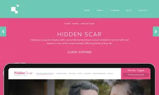 Preview of the Stryker Case Study