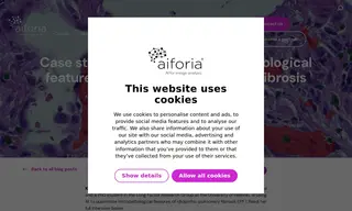 Preview of the University of Helsinki Case Study